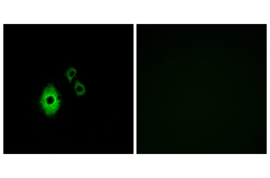 Immunofluorescence - Anti-KCNJ5 Antibody (G265) - Antibodies.com