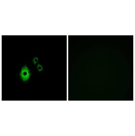 Immunofluorescence - Anti-KCNJ5 Antibody (G265) - Antibodies.com