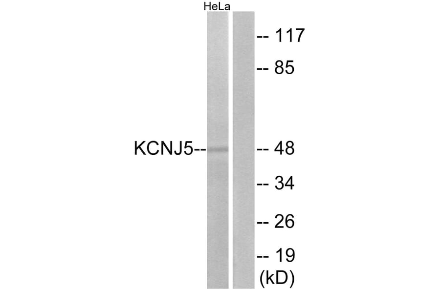 Western Blot - Anti-KCNJ5 Antibody (G265) - Antibodies.com