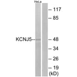 Western Blot - Anti-KCNJ5 Antibody (G265) - Antibodies.com