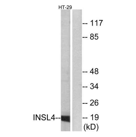 Western Blot - Anti-INSL4 Antibody (C15598) - Antibodies.com