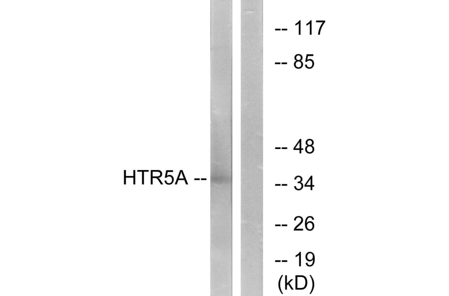 Western Blot - Anti-HTR5A Antibody (G015) - Antibodies.com