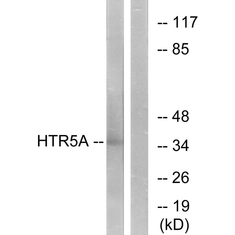 Western Blot - Anti-HTR5A Antibody (G015) - Antibodies.com