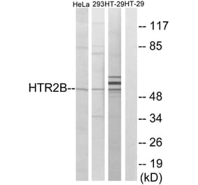 Western Blot - Anti-HTR2B Antibody (G007) - Antibodies.com