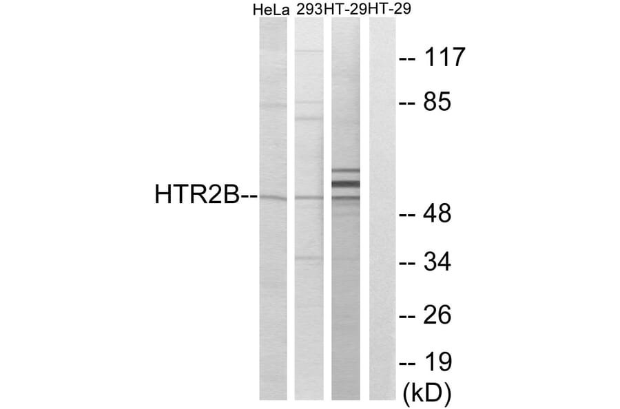 Western Blot - Anti-HTR2B Antibody (G007) - Antibodies.com