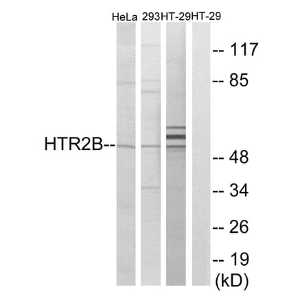 Western Blot - Anti-HTR2B Antibody (G007) - Antibodies.com