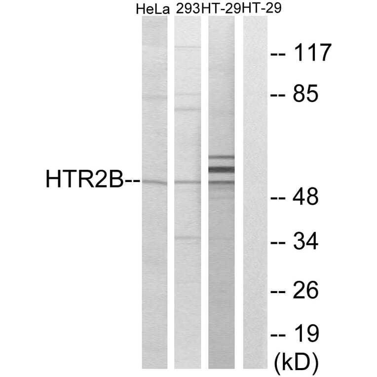 Western Blot - Anti-HTR2B Antibody (G007) - Antibodies.com