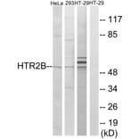 Western Blot - Anti-HTR2B Antibody (G007) - Antibodies.com