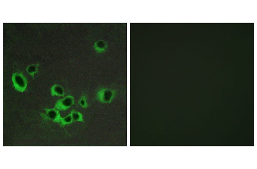 Immunofluorescence - Anti-HTR2B Antibody (G007) - Antibodies.com
