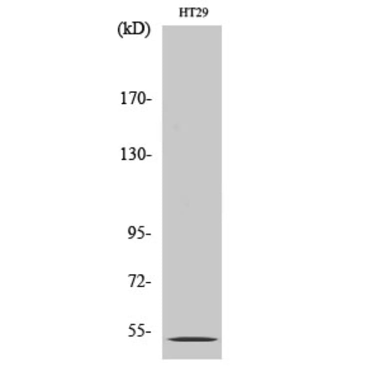 Western Blot - Anti-HTR2B Antibody (G007) - Antibodies.com