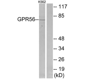 Western Blot - Anti-GPR56 Antibody (G346) - Antibodies.com