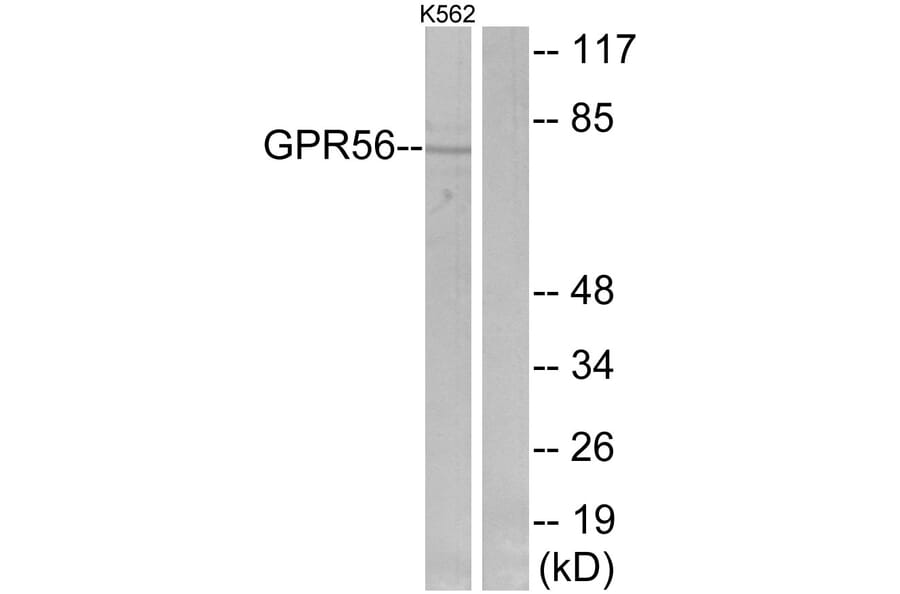 Western Blot - Anti-GPR56 Antibody (G346) - Antibodies.com