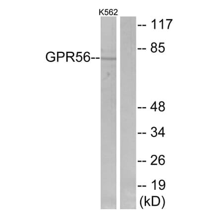 Western Blot - Anti-GPR56 Antibody (G346) - Antibodies.com