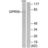 Western Blot - Anti-GPR56 Antibody (G346) - Antibodies.com