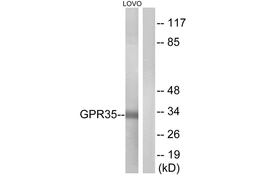 Western Blot - Anti-GPR35 Antibody (G338) - Antibodies.com