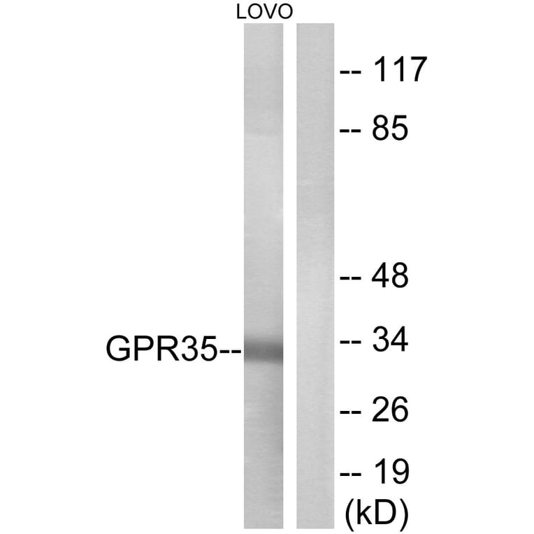 Western Blot - Anti-GPR35 Antibody (G338) - Antibodies.com