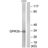 Western Blot - Anti-GPR35 Antibody (G338) - Antibodies.com