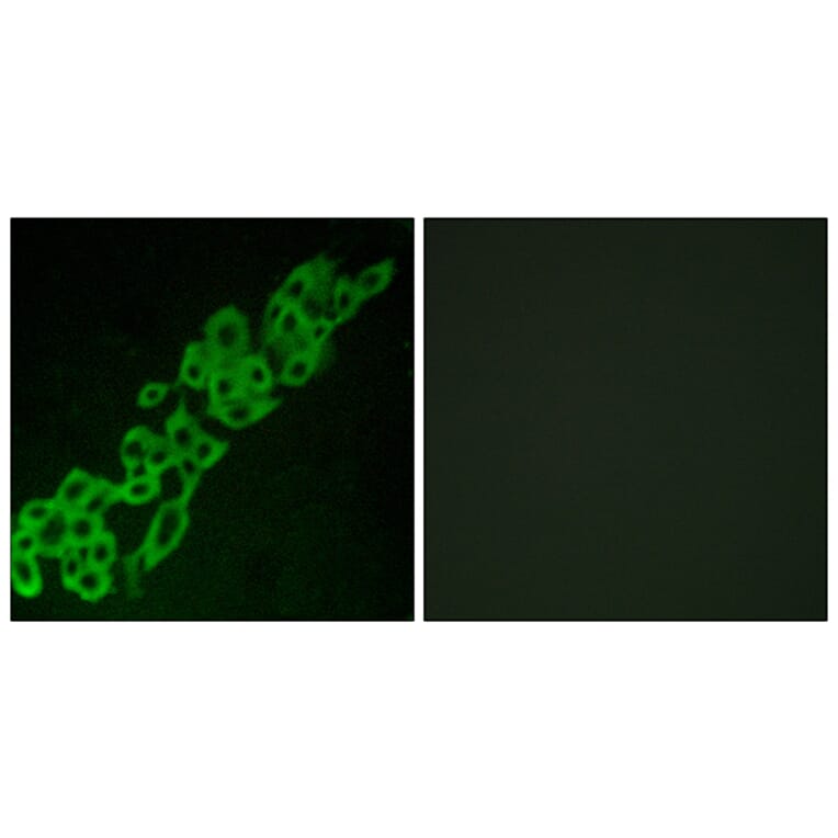 Immunofluorescence - Anti-GPR32 Antibody (G335) - Antibodies.com