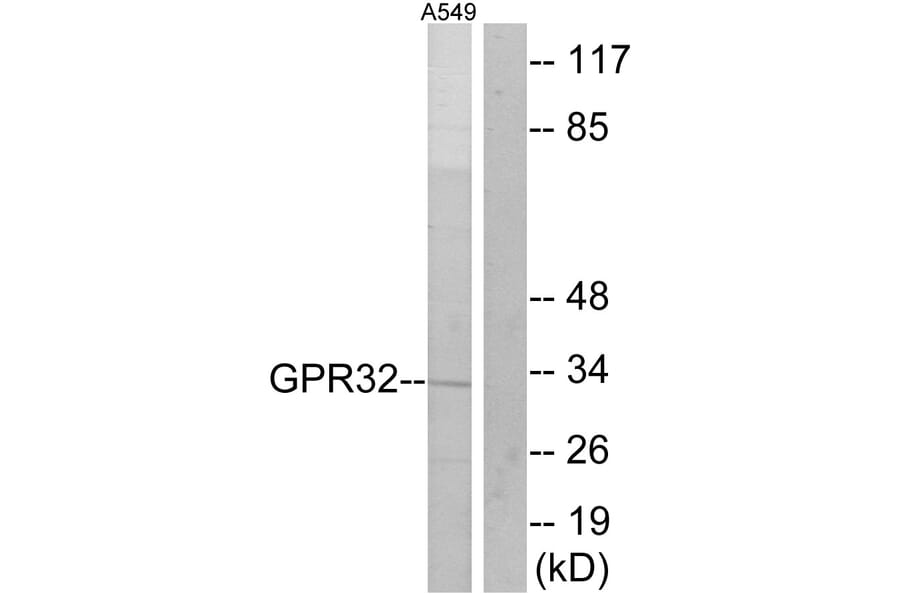 Western Blot - Anti-GPR32 Antibody (G335) - Antibodies.com
