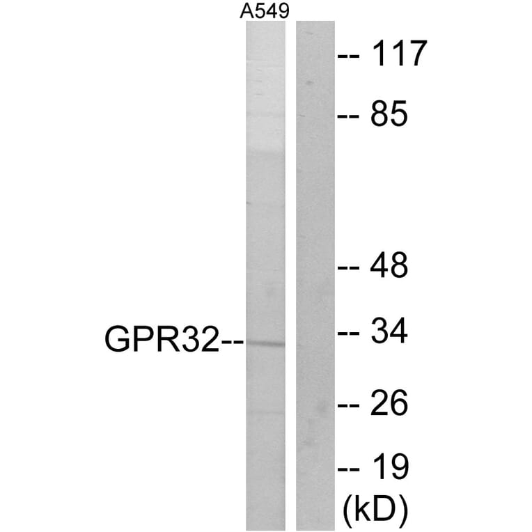 Western Blot - Anti-GPR32 Antibody (G335) - Antibodies.com