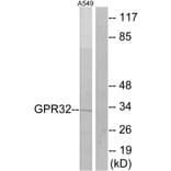 Western Blot - Anti-GPR32 Antibody (G335) - Antibodies.com