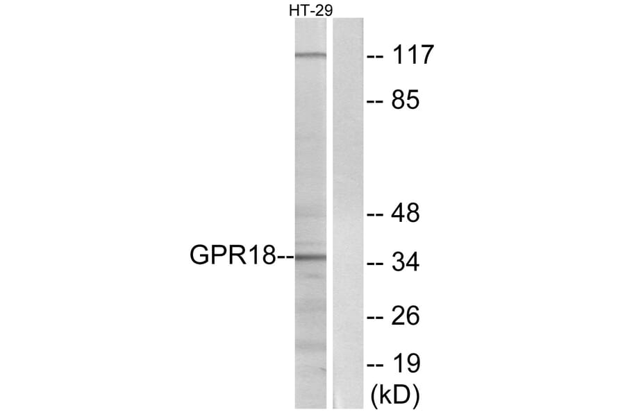 Western Blot - Anti-GPR18 Antibody (G147) - Antibodies.com