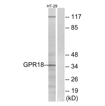 Western Blot - Anti-GPR18 Antibody (G147) - Antibodies.com