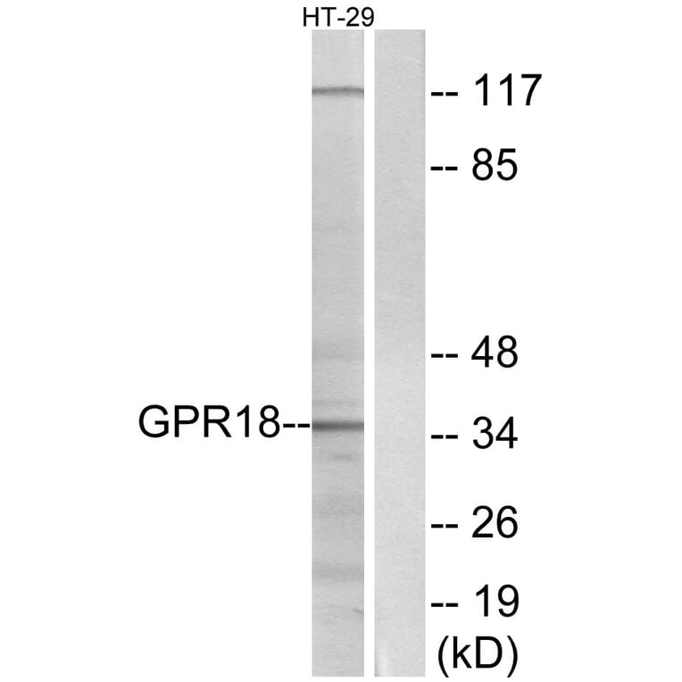 Western Blot - Anti-GPR18 Antibody (G147) - Antibodies.com