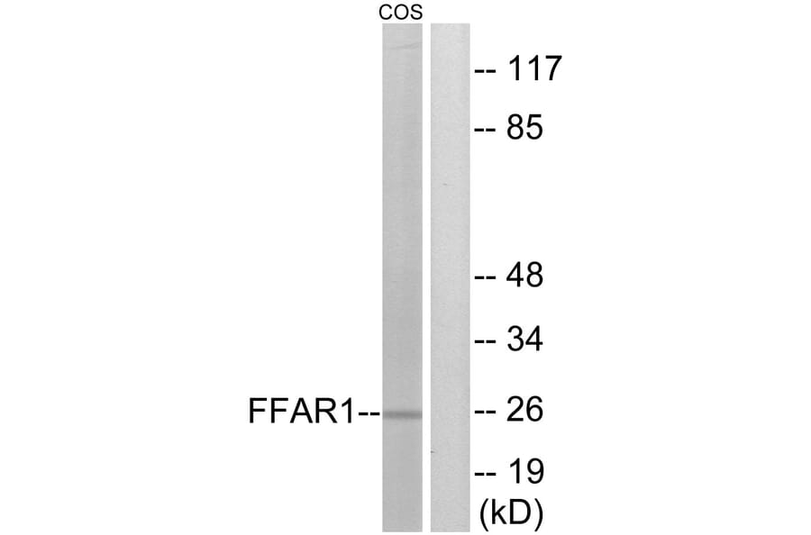 Western Blot - Anti-FFAR1 Antibody (G248) - Antibodies.com