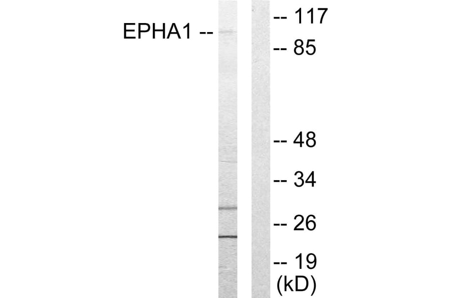 Western Blot - Anti-EPHA1 Antibody (C10446) - Antibodies.com
