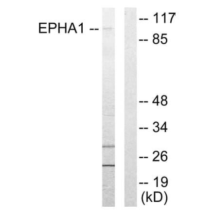 Western Blot - Anti-EPHA1 Antibody (C10446) - Antibodies.com