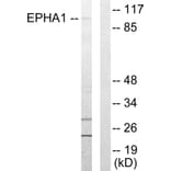 Western Blot - Anti-EPHA1 Antibody (C10446) - Antibodies.com