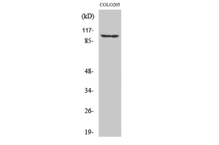 Western Blot - Anti-EPHA1 Antibody (C10446) - Antibodies.com