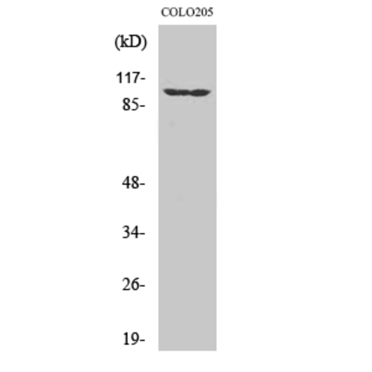 Western Blot - Anti-EPHA1 Antibody (C10446) - Antibodies.com