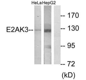 Western Blot - Anti-E2AK3 Antibody (C11790) - Antibodies.com