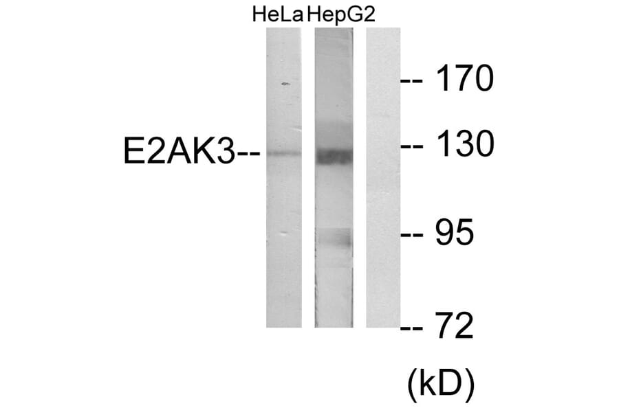 Western Blot - Anti-E2AK3 Antibody (C11790) - Antibodies.com