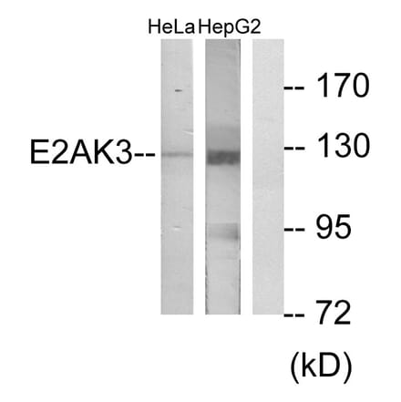 Western Blot - Anti-E2AK3 Antibody (C11790) - Antibodies.com