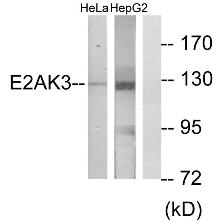 Western Blot - Anti-E2AK3 Antibody (C11790) - Antibodies.com