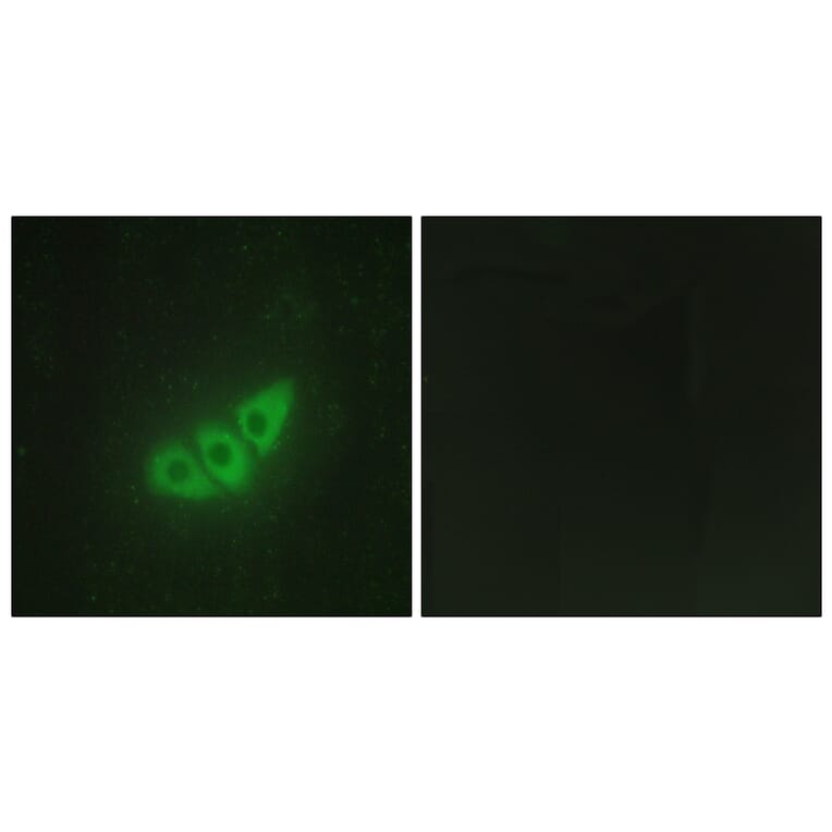 Immunofluorescence - Anti-E2AK3 Antibody (C11790) - Antibodies.com