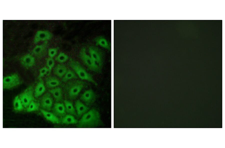 Immunofluorescence - Anti-CSRL1 Antibody (G229) - Antibodies.com