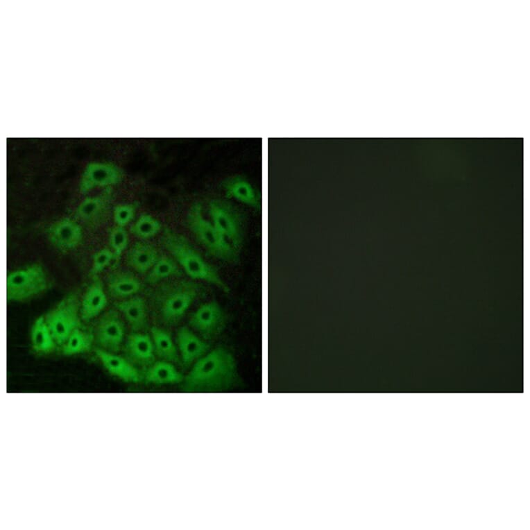 Immunofluorescence - Anti-CSRL1 Antibody (G229) - Antibodies.com