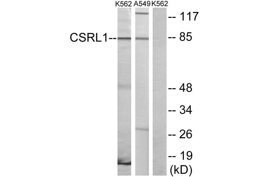 Western Blot - Anti-CSRL1 Antibody (G229) - Antibodies.com