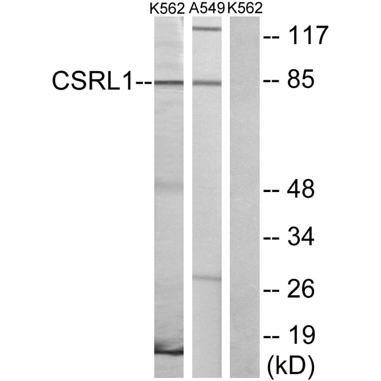 Western Blot - Anti-CSRL1 Antibody (G229) - Antibodies.com