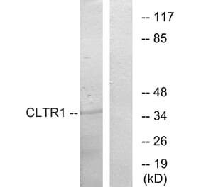 Western Blot - Anti-CLTR1 Antibody (G224) - Antibodies.com