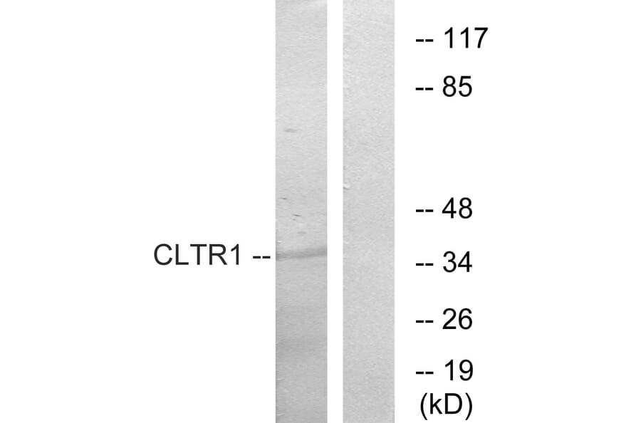 Western Blot - Anti-CLTR1 Antibody (G224) - Antibodies.com