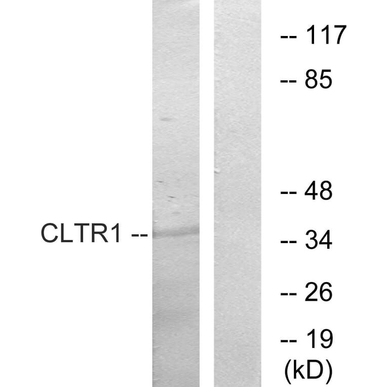Western Blot - Anti-CLTR1 Antibody (G224) - Antibodies.com