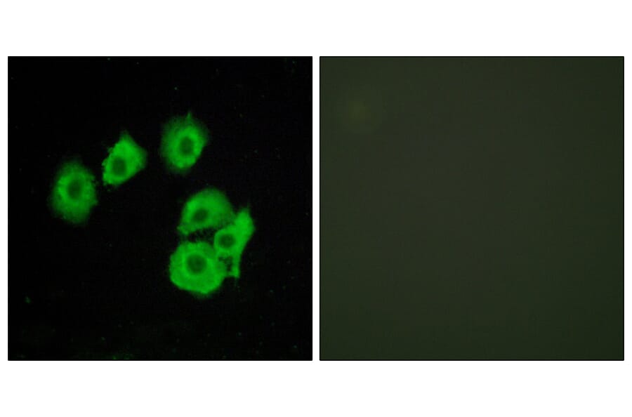 Immunofluorescence - Anti-CLTR1 Antibody (G224) - Antibodies.com