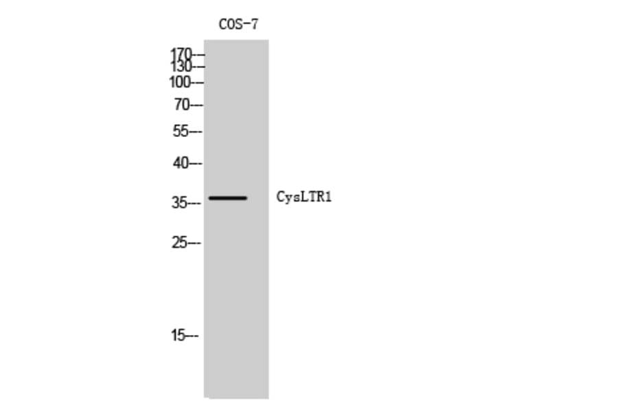 Western Blot - Anti-CLTR1 Antibody (G224) - Antibodies.com
