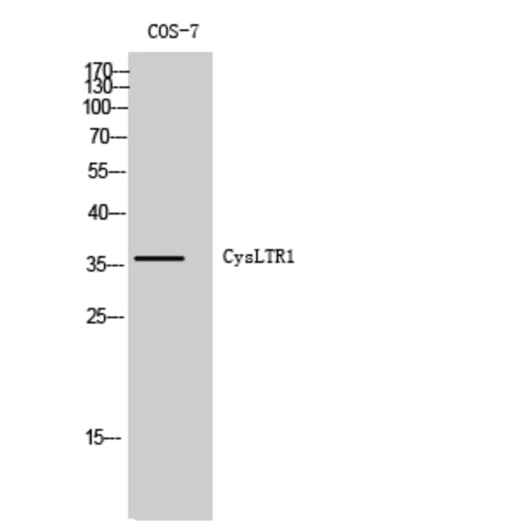 Western Blot - Anti-CLTR1 Antibody (G224) - Antibodies.com