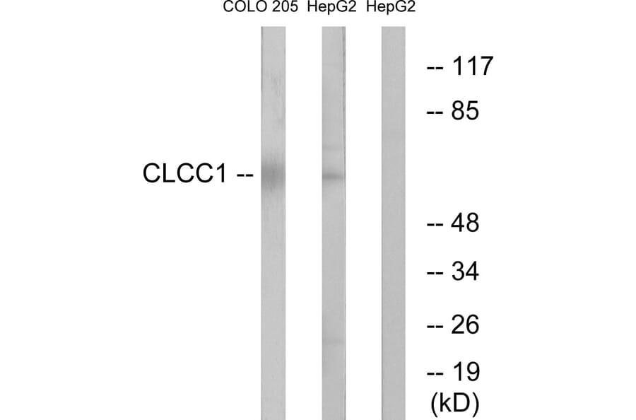 Western Blot - Anti-CLCC1 Antibody (C15076) - Antibodies.com